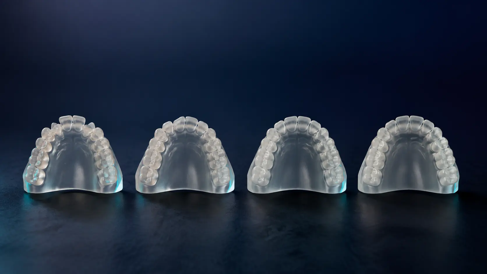 Four staged clear aligner models in a row, each one a step further along the treatment